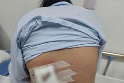 Cảnh báo đắp lá trị mụn nhọt gây hoại tử nặng