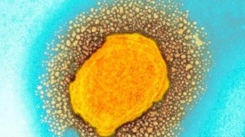 Mỹ xác nhận 9 trường hợp nhiễm đậu mùa khỉ ở 7 bang