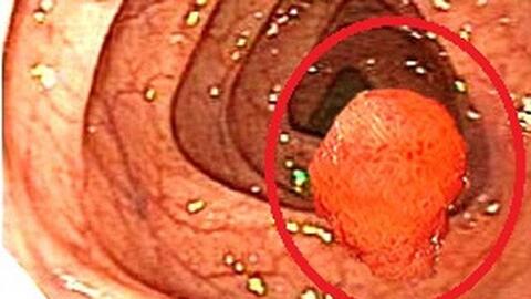 Chuyên gia Bệnh viện K trung ương vạch mặt thủ phạm có thể khiến cả gia đình bị ung thư