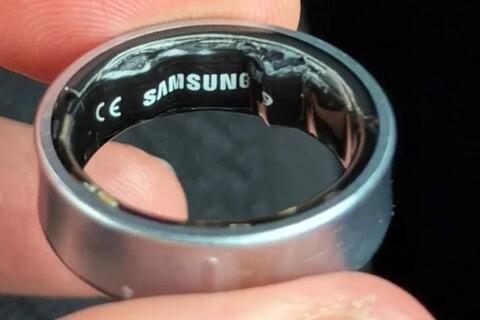 Pin Samsung Galaxy Ring phồng to khiến người dùng nhập viện khẩn cấp