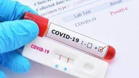 Giảm giá xét nghiệm Covid-19: Test nhanh không quá 78.000 đồng