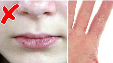 5 dấu hiệu cho thấy bạn đang lão hóa nhanh hơn bình thường, điều số 4 rất nhiều người "mắc"