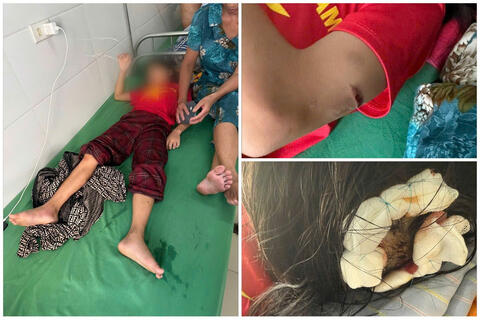 Trường học lên tiếng vụ học sinh lớp 5 nghi bị cha dượng bạo hành