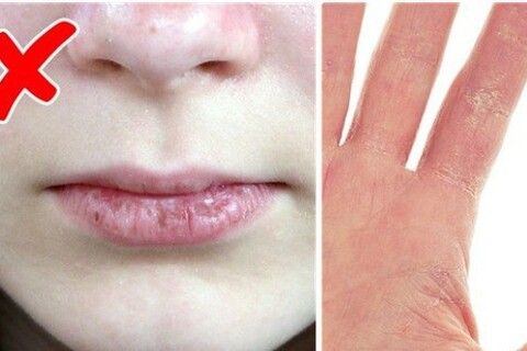 5 dấu hiệu cho thấy bạn đang lão hóa nhanh hơn bình thường, điều số 4 rất nhiều người "mắc"