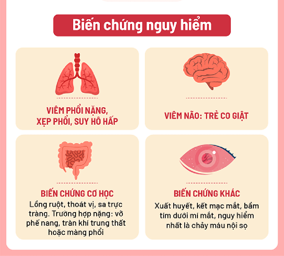 Trẻ mắc ho gà, khi nào cần đưa đi khám? - Ảnh 4