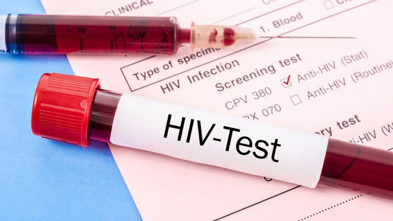 Phát hiện sớm nhiễm HIV là rất quan trọng để điều trị và quản lý hiệu quả. hiv.jpg