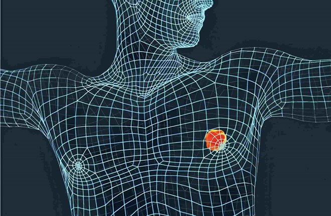 Nam giới cũng có thể mắc ung thư vú