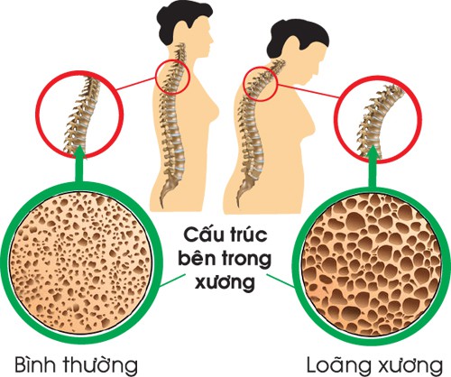 Đậu xanh - Thực phẩm “vàng” cho sức khỏe - Ảnh 1.